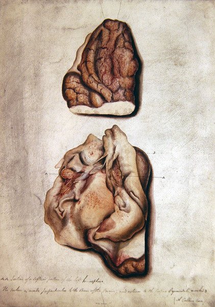 Estudo do Cérebro III, c.1850 (aguarela sobre papel) de William Lover