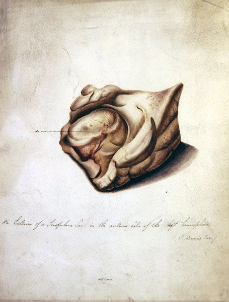 Estudo do Cérebro II, c.1850 (aguarela sobre papel) de William Lover