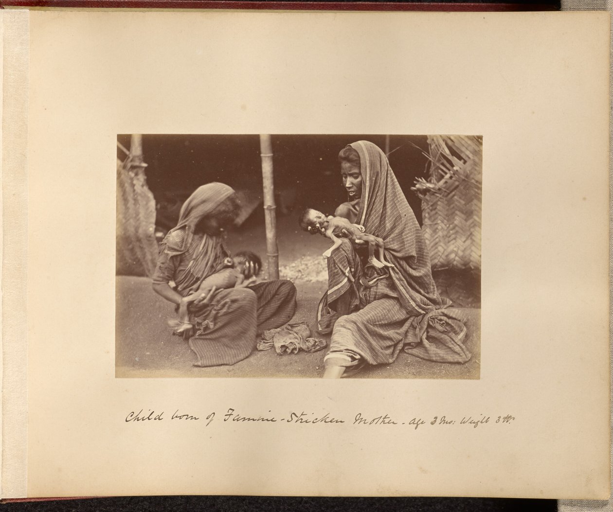 Criança nascida de mãe atingida pela fome - Idade: 3 meses, Peso: 3 lbs. de Willoughby Wallace Hooper