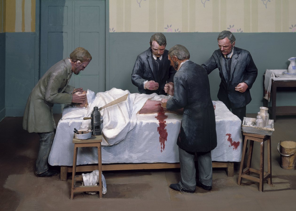 Antissépticos Cirúrgicos Uma operação anti-séptica de Ferdinand Georg Waldmuller