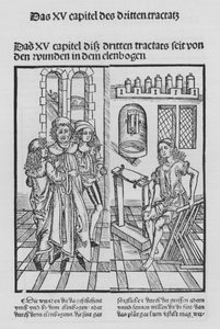 O Livro de Cirurgia de Hieronymus Brunschwig (litho) de (after) German School