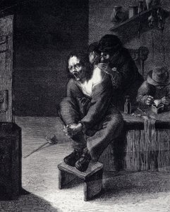A operação cirúrgica Gravura após uma pintura de Adrien Brauwer (fez 1608) Século XVII de Adriaen (after) Brouwer