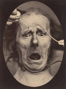 Electro-Fisiologia, Figura 64, 1854-56, impresso em 1862.