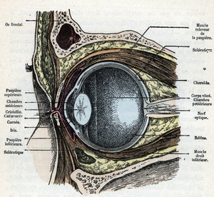 Corte vertical de um globo ocular com gravação de cataratas da colecção privada "Nature and Man" de Rengade 1881 de Alphonse Demarle
