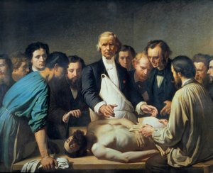 O Doutor Alfred Velleau (1795-1867) na Caridade vai proceder a uma autópsia Um médico rodeado pelos seus alunos que estão preparados para intervir num cadáver. Pintura de François Feyen Perrin (1826-1888). Século XIX. Tours musee des Beaux Arts - Alfred Ve de Auguste (after) Feyen Perrin