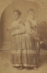 Impressão de albumina de Millie e Christine McCoy, 1880s -1890s.