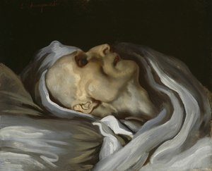 Théodore Géricault em seu leito de morte, 1824.