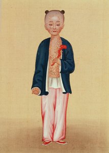 Criança com varíola (wc no papel) de Chinese School