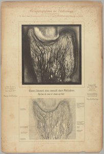 Polpa da coroa de um sup. molar humano de Dr. Alfred Gysi