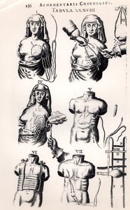 Operando no câncer de mama, de Armamentarii Chirurgici, de Johannes Schultes (1595-1645), publicado em Amsterdã, 1672 de Dutch School
