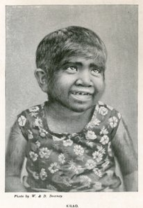 Krao, The Missing Link, exibido no aquário, Westminster, Londres, em 1887 de English Photographer