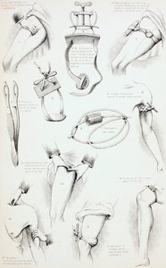 Métodos de Prisão Sangrar, c.1890 de English School