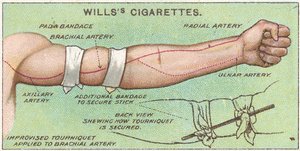 Torniquete, no.11 da série de primeiros socorros de cartões de Willss Cigarettes, 1913 de English School