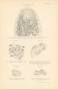 Zotten bei Cholera (Farblithografie) von English School