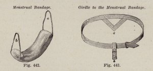 Ligadura menstrual; Cinturão para a ligadura menstrual (litho) de European School