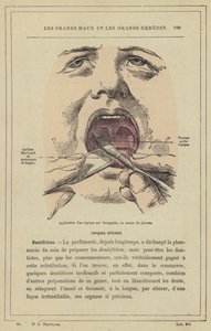 Aplicação de um tópico sobre a amígdala, utilizando o pincel (cor litho) de French School