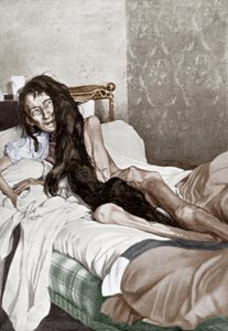 Blanche Monnier no hospital, Poitiers, junho de 1901 (gravura) de French School