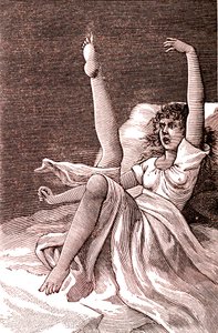 Histeria, um fenómeno extremamente mental, psicoses e psiconeuroses.1887 (gravura) de French School
