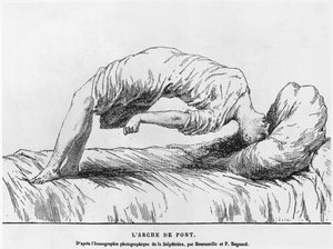 Histeria e sonambulismo, de Les Maladies Epidemiques de l&39;Esprit de Paul Regnard (1850-1927) 1884 de French School