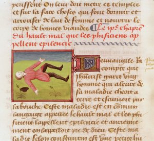 Ms 22532 Paciente que sofre de um ataque epiléptico, de O Livro das Coisas das Coisas de Barthelemy English, c. 1410-1415 de French School