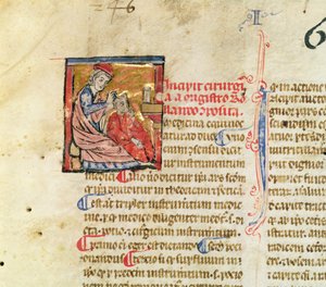 Senhora Lat. 7134 fol.1 Trepanation, da Chirugie da Master Rolandi de French School