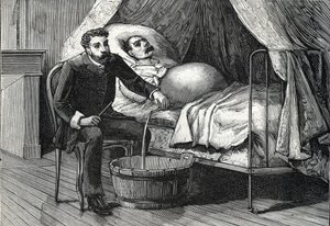 Paciente com cirrose hepática avançada, médico realizando uma punção (gravura) 1888 de French School