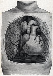 ruptura do aneurisma (gravura) 1888 de French School