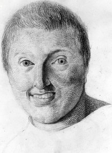 Um epiléptico, -in "Etude de la physiognomy des alienés", desenho de Gabriel