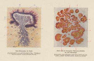 Actinomyces bovis (litografia a cores) de German School