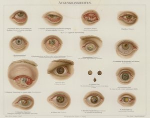 Distúrbios oculares (cor litho) de German School