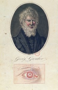 Georg Gamber, um albino de German School