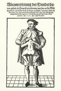 Hans Kaltenbrunn e o seu gémeo conjunto não desenvolvido (gravura) de German School