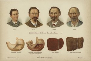 Os efeitos do abuso do álcool (cor litho) de German School