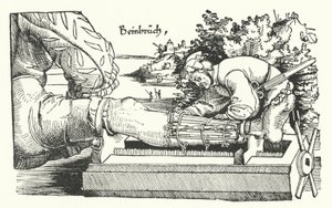 Tratamento de uma perna fracturada (gravação) de German School