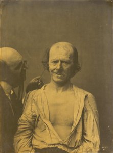 Um rosto descontraído (esquerda); falsa alegria ou riso (direita),1854-1856, impresso em 1862 (fotografia)