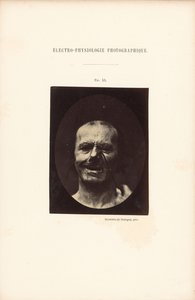 Eletrofisiologia fotográfica, Figura 53 de Guillaume Benjamin Duchenne