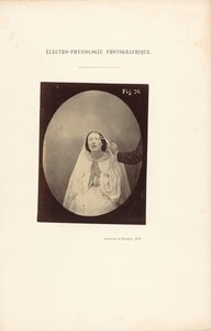 Eletrofisiologia fotográfica, Figura 76 de Guillaume Benjamin Duchenne
