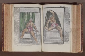anatomia feminina, de História, com as mais generosas adições ao mundini anatomia, byJacopo Berengarlo da Carpi (c.1460-c.1530), publicado em Bolonha, (impressão cor woodblock) 1521 de Italian School