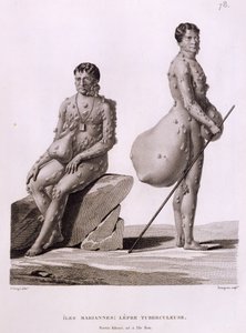 Ilhas Marianas do Norte: Dois Homens Sofrendo de Tuberculose, de &39;Viagem ao Redor do Mundo nas Corvetas de Urania 1817-20&39; gravado por Bourgeois, publicado em 1825