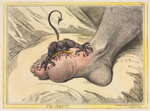 A gota de James Gillray