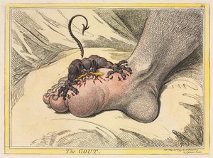 A gota, 1799. de James Gillray