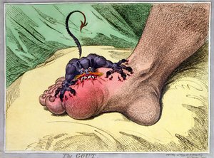 The Gout, publicado por Hannah Humphrey em 1799 (gravura de softdground colorido à mão)