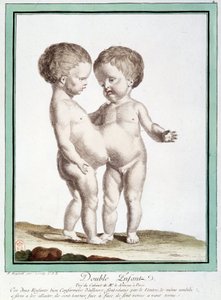 Crianças siamesas - em "Os Desvios da Natureza" de Régnault de Jean Baptiste Regnault