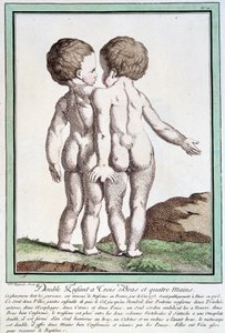 Crianças siamesas - em "Les desvios de la nature" de Régnault de Jean Baptiste Regnault