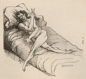 Epilepsia histérica, ataque, contorções, figo. 3 de &39;Iconografia fotográfica de La Salpetriere&39; de Bourneville e P. Regnard, Paris, 1876 de Jean Francois Badoureau