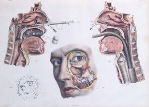 Operação Nasal, placa de &39;Tratado Completo da Anatomia do Homem&39; de Jean-Baptiste Marc Bourgery (1797-1849) 1866-67 de Nicolas Henri Jacob