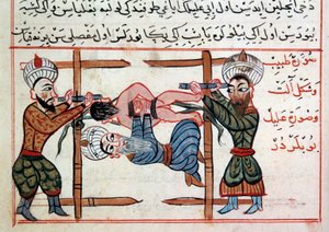 Redução de uma fractura. Miniatura de um Tratamento de Medicina Turca por Sharaf al-din de Ottoman School