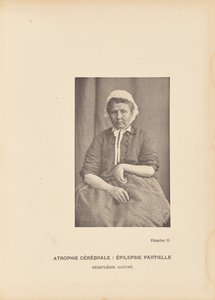 Atrofia cerebral: Epilepsia parcial Hemiplegia esquerda de Paul Marie Léon Regnard