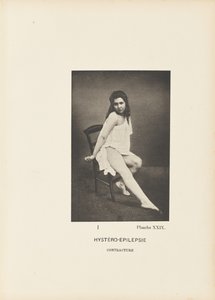 Contractura histero-epilética de Paul Marie Léon Regnard