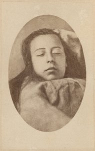 Ataque da histeria, segunda fase, ilustração da &39;Iconografia Fotográfica de La Salpetriere&39; de Bourneville et P. Regnard, placa III, Paris, 1876 (impressão albumen) de Paul Regnard